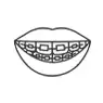 tooth aligners